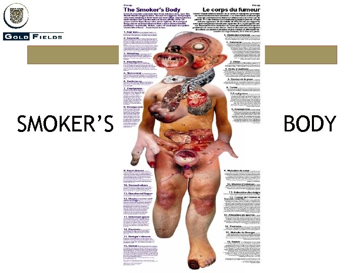 SMOKER’S BODY 