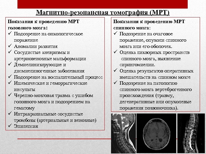 Магнитно-резонансная томография (МРТ) Показания к проведению МРТ головного мозга: ü Подозрение на онкологическое поражение