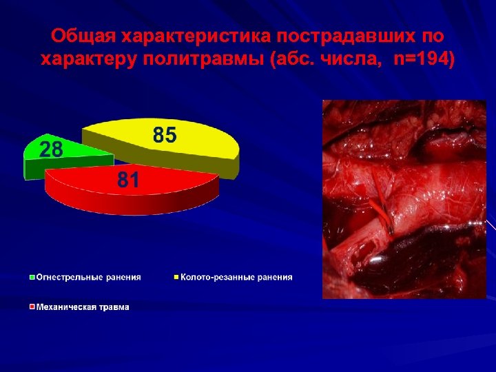 Общая характеристика пострадавших по характеру политравмы (абс. числа, n=194) 