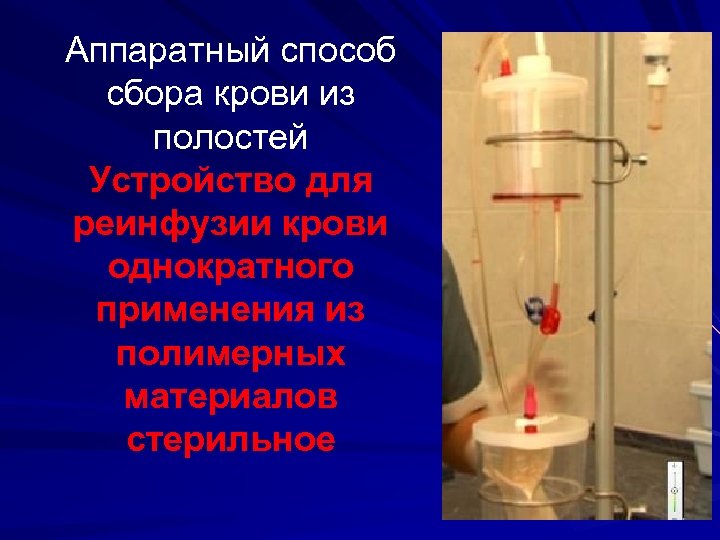 Аппаратный способ сбора крови из полостей Устройство для реинфузии крови однократного применения из полимерных