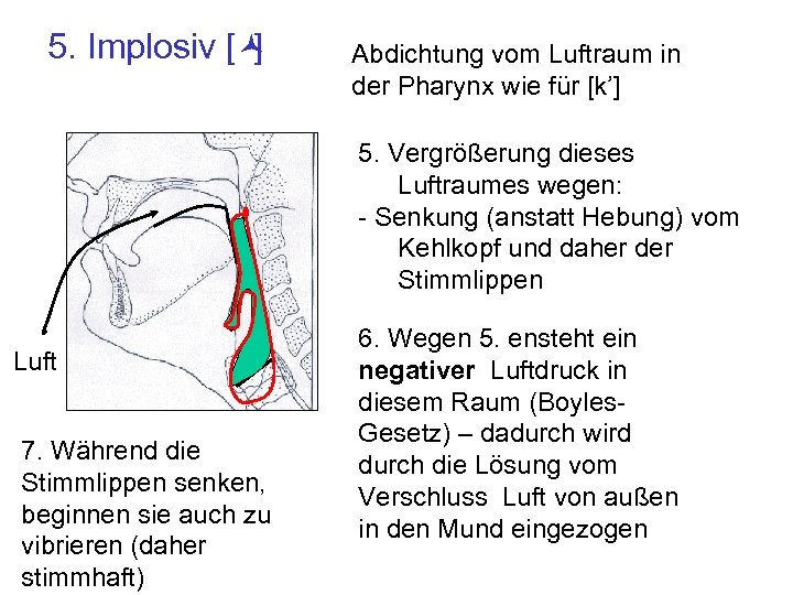 5. Implosiv [© ] Abdichtung vom Luftraum in der Pharynx wie für [k’] 5.