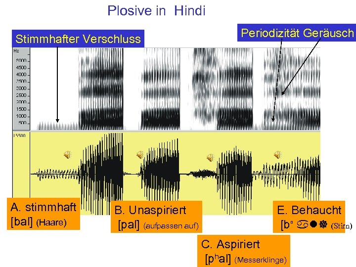 Plosive in Hindi Stimmhafter Verschluss A. stimmhaft [bal] (Haare) B. Unaspiriert [pal] (aufpassen auf)