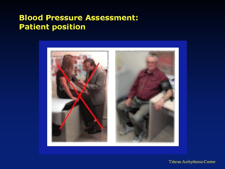 Blood Pressure Assessment: Patient position Tehran Arrhythmia Center 