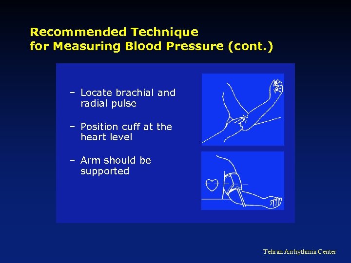 Recommended Technique for Measuring Blood Pressure (cont. ) – Locate brachial and radial pulse