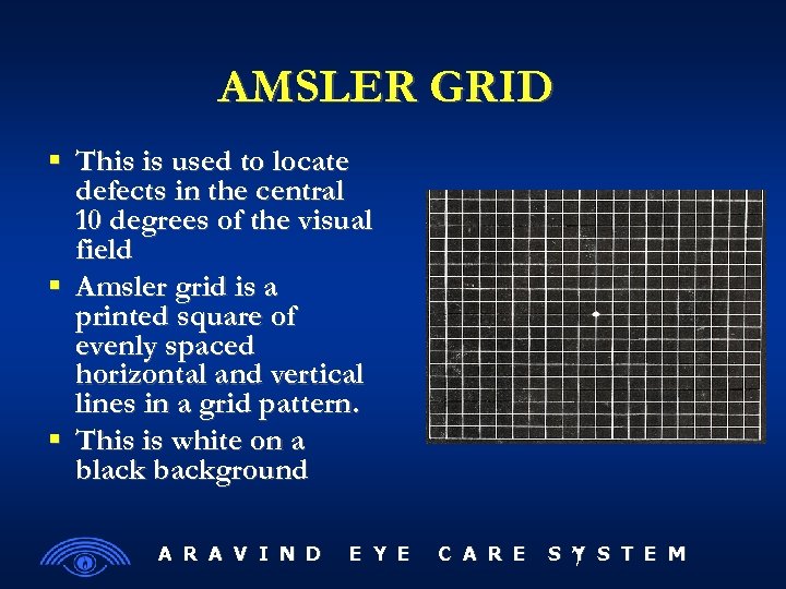 AMSLER GRID This is used to locate defects in the central 10 degrees of