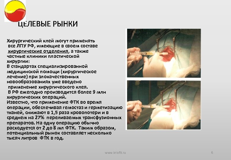 ЦЕЛЕВЫЕ РЫНКИ Хирургический клей могут применять все ЛПУ РФ, имеющие в своем составе хирургические
