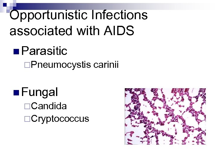 Opportunistic Infections associated with AIDS n Parasitic ¨Pneumocystis carinii n Fungal ¨Candida ¨Cryptococcus 