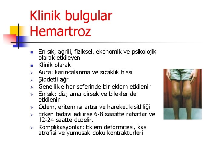 Klinik bulgular Hemartroz n n Ø Ø Ø Ø En sık, agrili, fiziksel, ekonomik