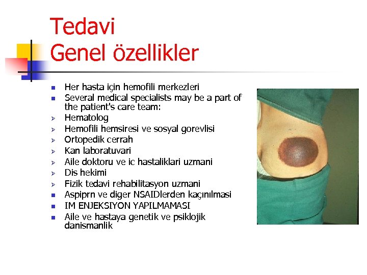 Tedavi Genel özellikler n n Ø Ø Ø Ø n n n Her hasta