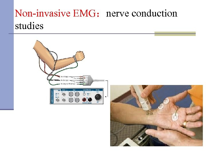 Non-invasive EMG：nerve conduction studies 