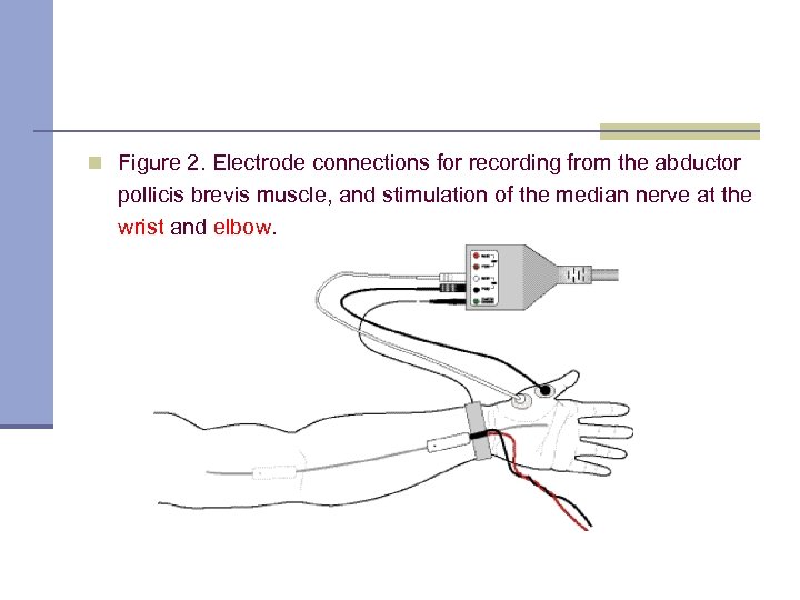 n Figure 2. Electrode connections for recording from the abductor pollicis brevis muscle, and