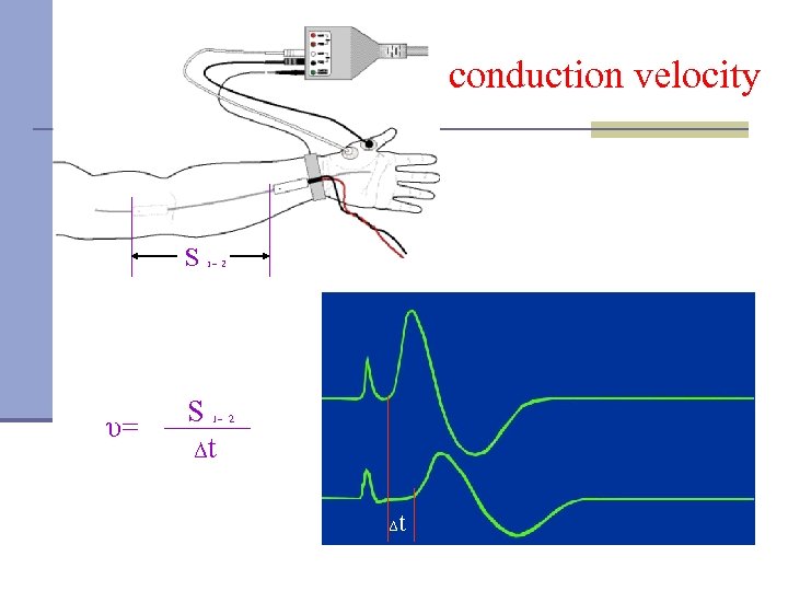 conduction velocity S - 1 2 υ= S - Δt 1 2 Δ t