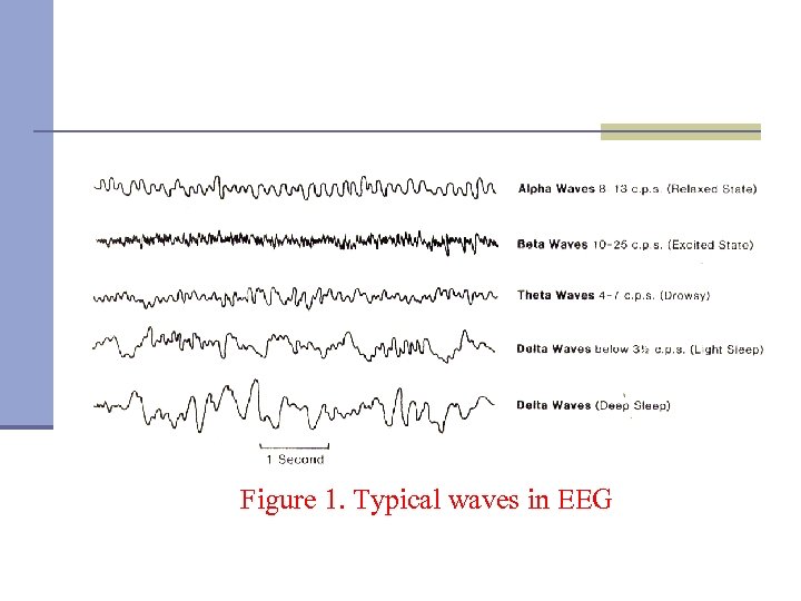 Figure 1. Typical waves in EEG 