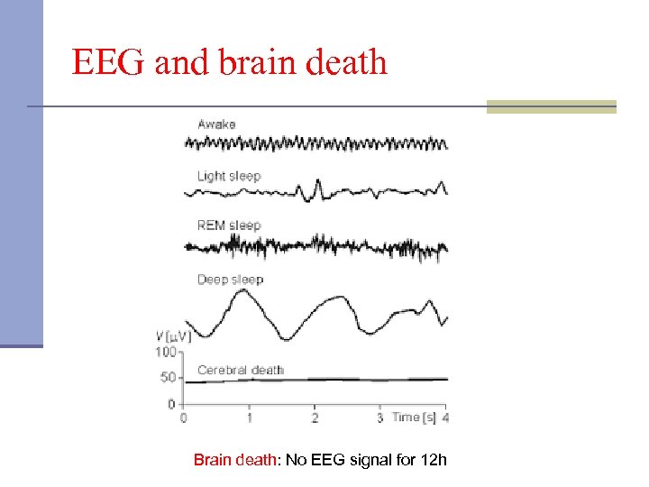 EEG and brain death Brain death: No EEG signal for 12 h 