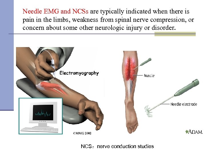 Needle EMG and NCSs are typically indicated when there is pain in the limbs,