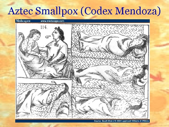 Aztec Smallpox (Codex Mendoza) 