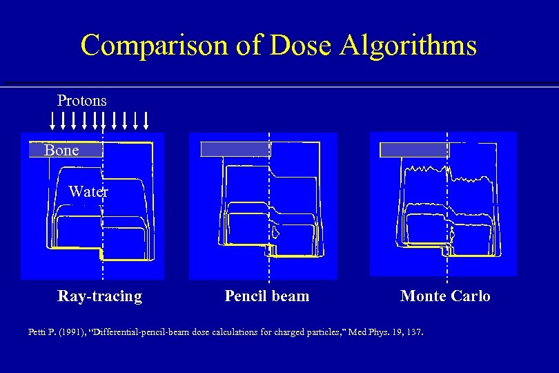 Comparison of Dose Algorithms Protons Bone Water Ray-tracing Pencil beam Monte Carlo Petti P.