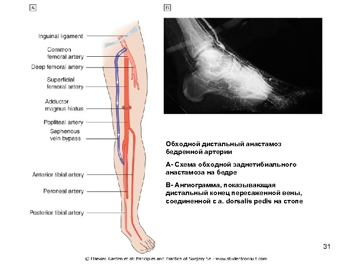 Узлы вен нижних конечностей. A dorsalis pedis перевод.