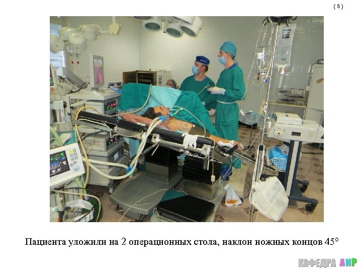 (8) Пациента уложили на 2 операционных стола, наклон ножных концов 45° 