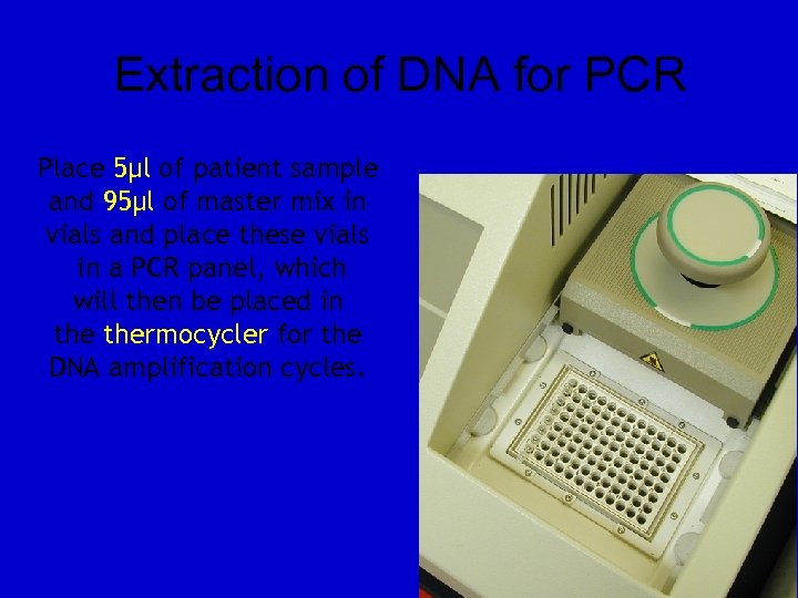 Extraction of DNA for PCR Place 5µl of patient sample and 95µl of master