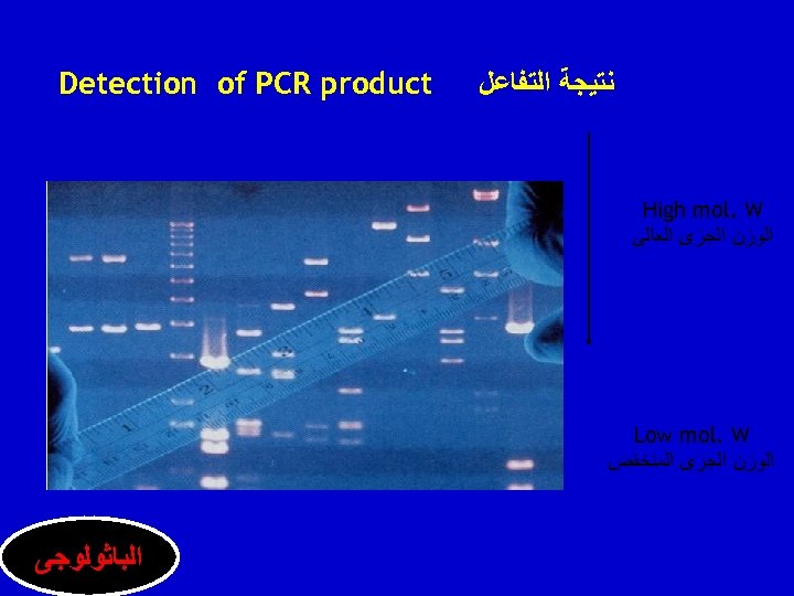  ﻧﺘﻴﺠﺔ ﺍﻟﺘﻔﺎﻋﻞ Detection of PCR product High mol. W ﺍﻟﻮﺯﻥ ﺍﻟﺠﺰﻯ ﺍﻟﻌﺎﻟﻰ Low