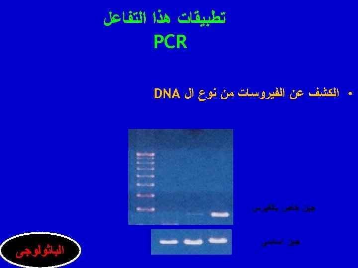  ﺗﻄﺒﻴﻘﺎﺕ ﻫﺬﺍ ﺍﻟﺘﻔﺎﻋﻞ PCR • ﺍﻟﻜﺸﻒ ﻋﻦ ﺍﻟﻔﻴﺮﻭﺳﺎﺕ ﻣﻦ ﻧﻮﻉ ﺍﻝ DNA ﺟﻴﻦ