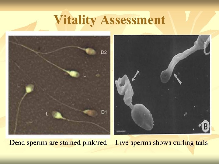 Vitality Assessment Dead sperms are stained pink/red Live sperms shows curling tails 