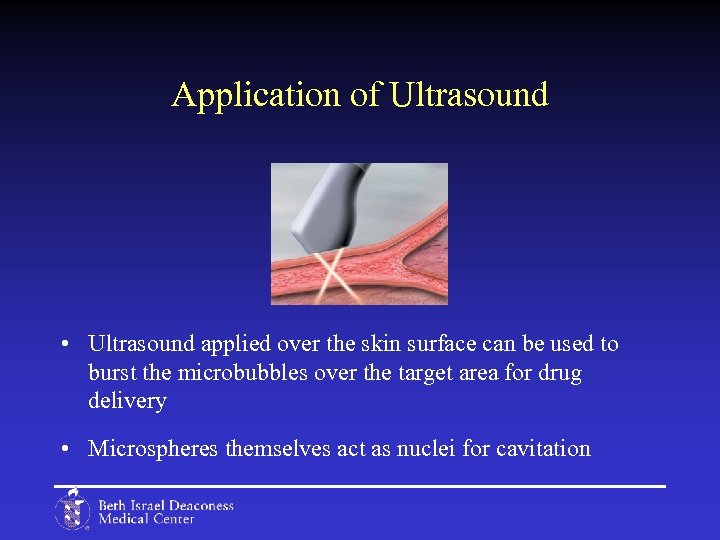 Application of Ultrasound • Ultrasound applied over the skin surface can be used to