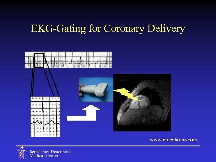 EKG-Gating for Coronary Delivery www. emedhome. com 