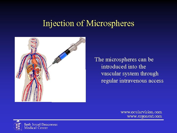 Injection of Microspheres The microspheres can be introduced into the vascular system through regular