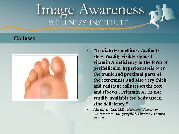 Calluses • “In diabetes mellitus…patients show readily visible signs of vitamin A deficiency in