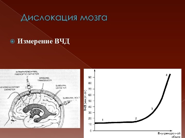 Дислокация мозга Измерение ВЧД 