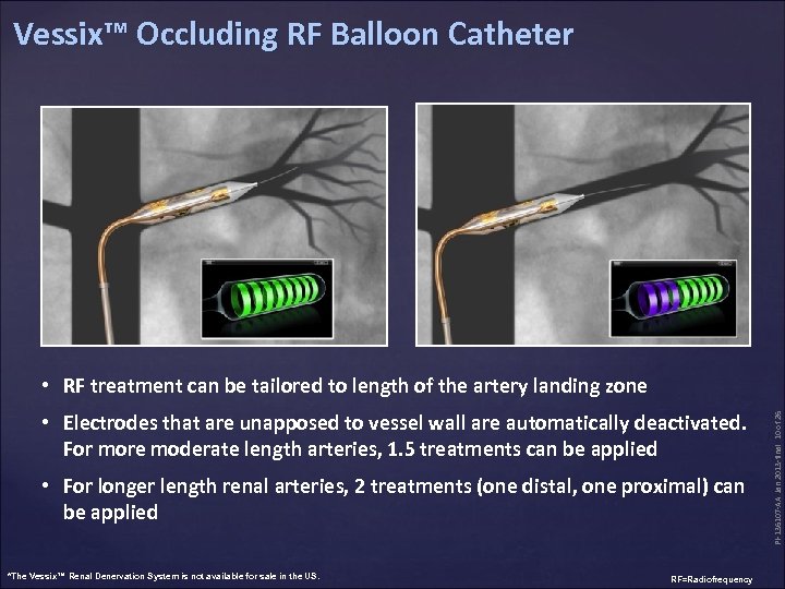 Vessix™ Occluding RF Balloon Catheter • Electrodes that are unapposed to vessel wall are