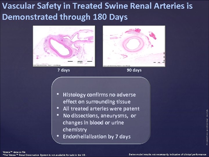 Vascular Safety in Treated Swine Renal Arteries is Demonstrated through 180 Days 7 days