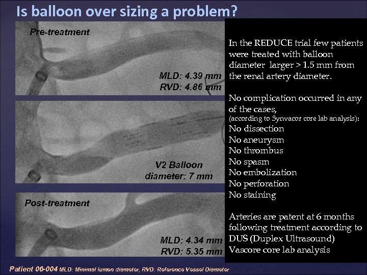 Is balloon over sizing a problem? Pre-treatment In the REDUCE trial few patients were