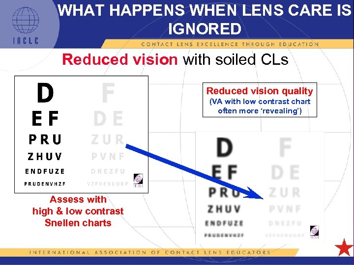 WHAT HAPPENS WHEN LENS CARE IS IGNORED Reduced vision with soiled CLs Reduced vision
