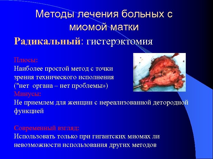 Методы лечения больных с миомой матки Радикальный: гистерэктомия Плюсы: Наиболее простой метод с точки