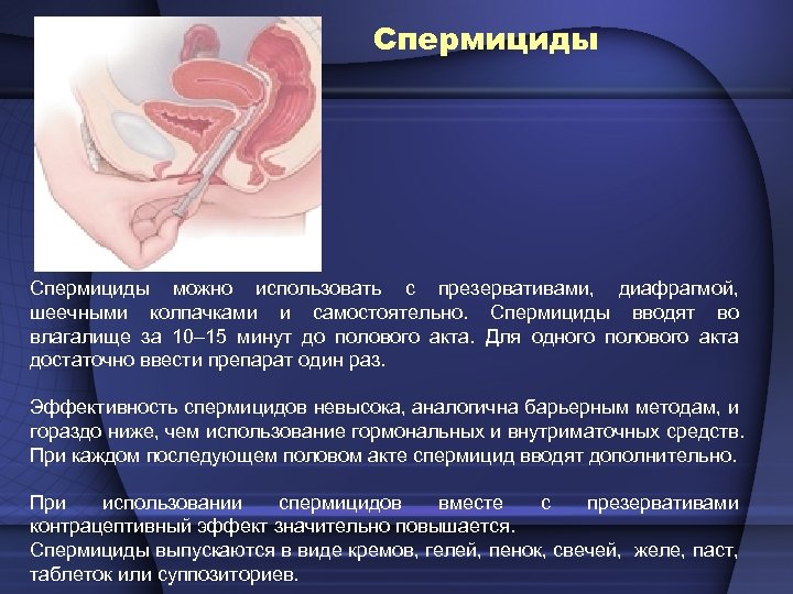 Спермициды можно использовать с презервативами, диафрагмой, шеечными колпачками и самостоятельно. Спермициды вводят во влагалище