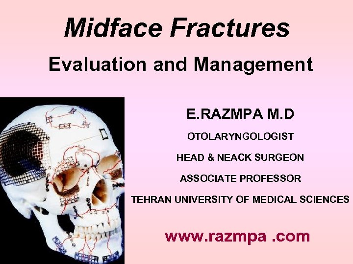 Midface Fractures Evaluation and Management E. RAZMPA M. D OTOLARYNGOLOGIST HEAD & NEACK SURGEON