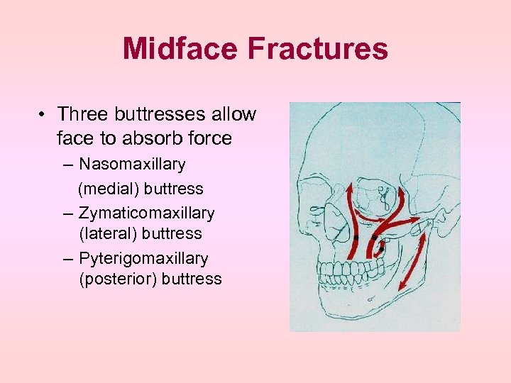 Midface Fractures • Three buttresses allow face to absorb force – Nasomaxillary (medial) buttress