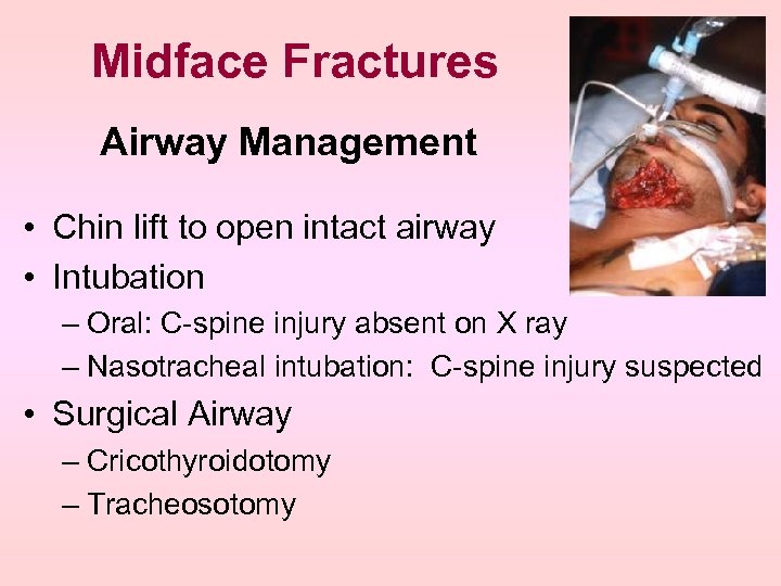 Midface Fractures Airway Management • Chin lift to open intact airway • Intubation –