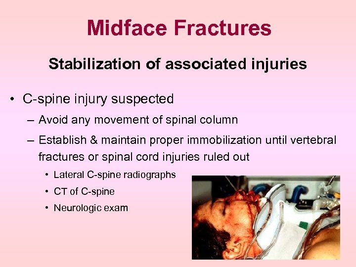 Midface Fractures Stabilization of associated injuries • C-spine injury suspected – Avoid any movement