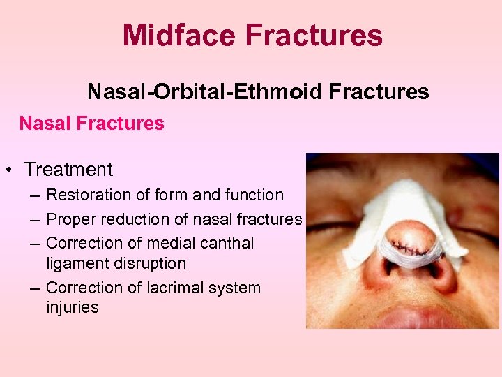 Midface Fractures Nasal-Orbital-Ethmoid Fractures Nasal Fractures • Treatment – Restoration of form and function