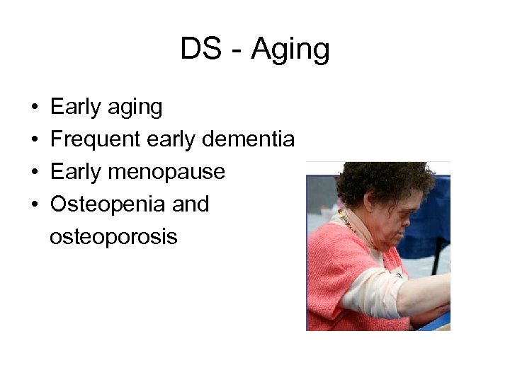 DS - Aging • • Early aging Frequent early dementia Early menopause Osteopenia and