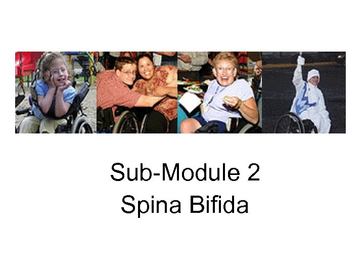 Spina Bifida Sub-Module 2 Spina Bifida 
