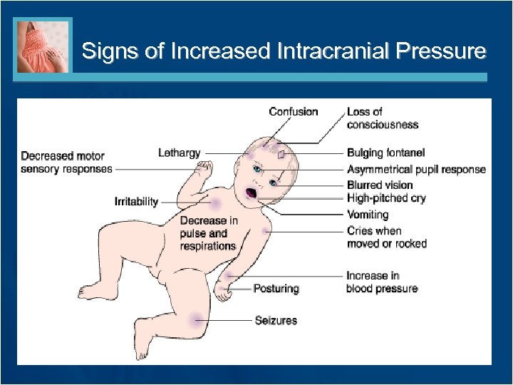 Signs of Increased Intracranial Pressure 