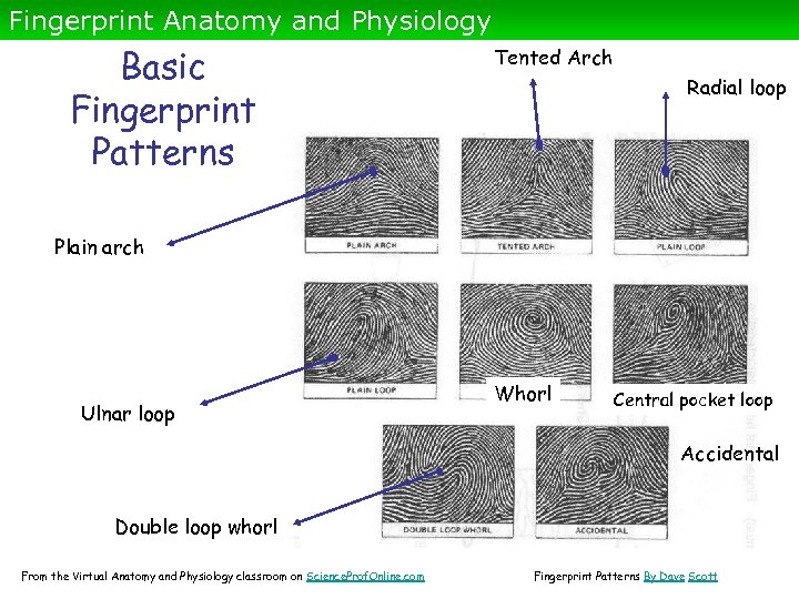 Fingerprint Anatomy and Physiology Basic Fingerprint Patterns Tented Arch Radial loop Plain arch Ulnar