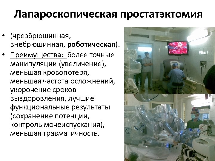 Лапароскопическая простатэктомия • (чрезбрюшинная, внебрюшинная, роботическая). • Преимущества: более точные манипуляции (увеличение), меньшая кровопотеря,