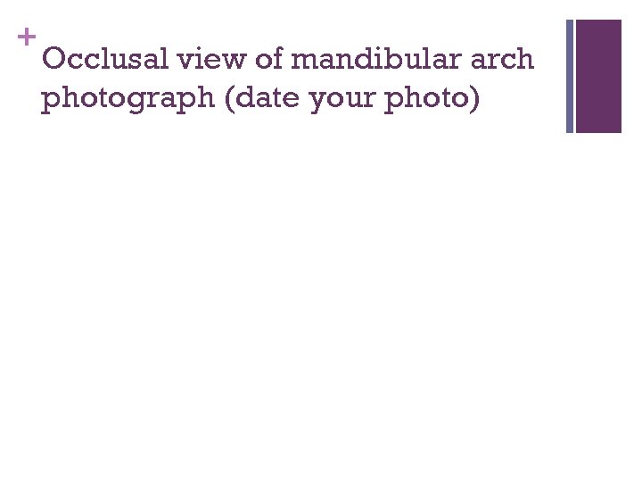+ Occlusal view of mandibular arch photograph (date your photo) 