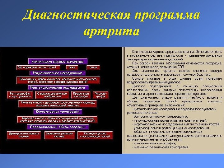 Диагностическая программа артрита 